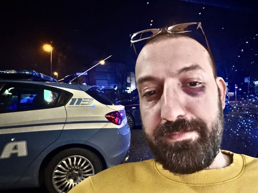 Lucca, interviene per difendere un ragazzo aggredito e finisce in ospedale: la storia di Sebastian Palmieri