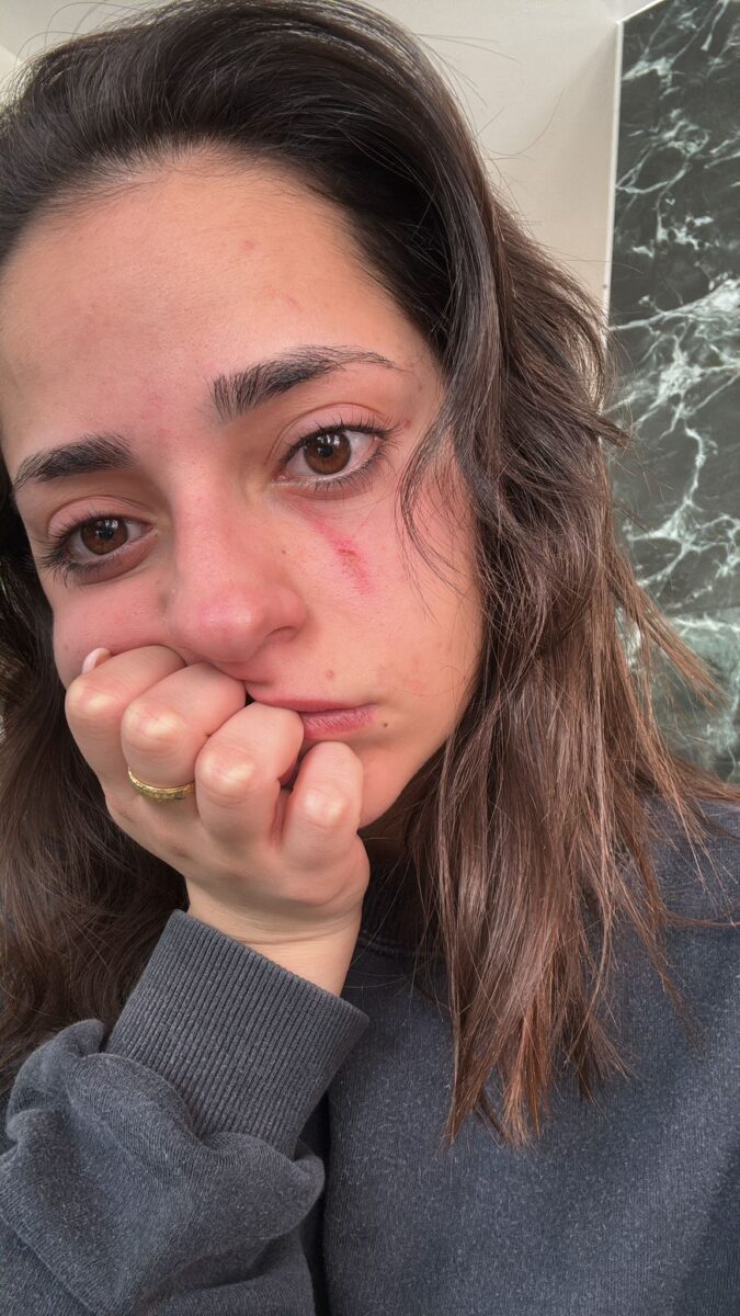 La storia di Maria, offesa e picchiata in pubblico da un uomo che poi è scappato via messo in fuga dai passanti